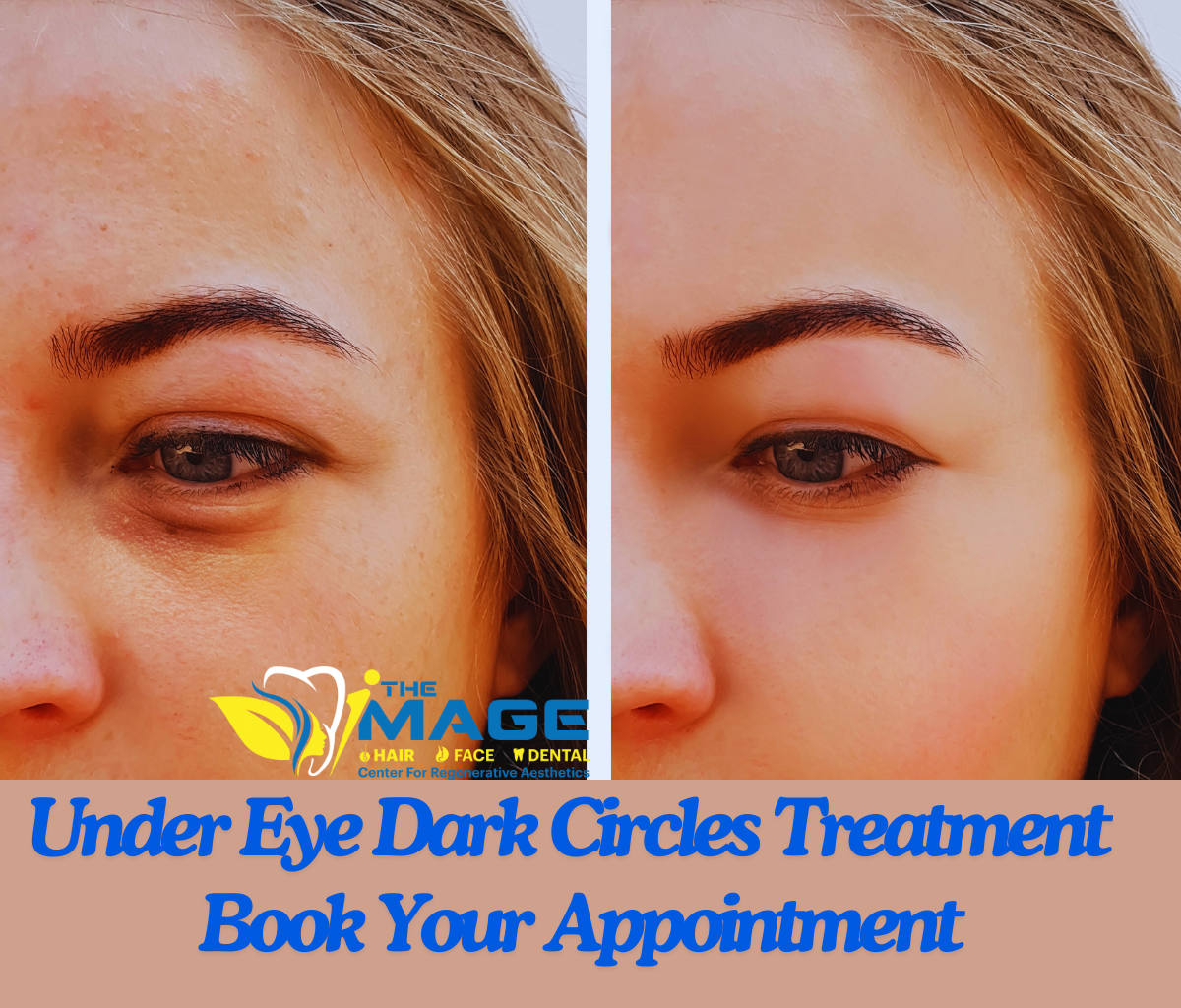 Say-Goodbye-to-Under-Eye-Dark-Circles