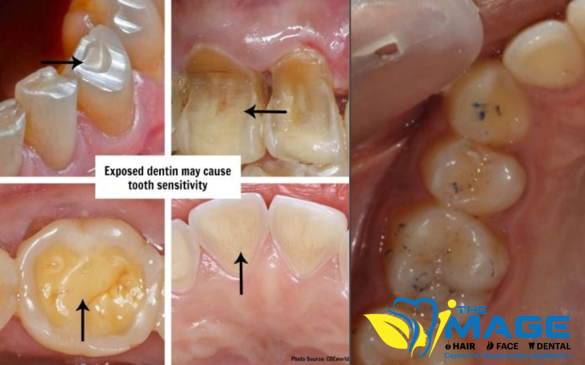 Treatments-for-Teeth-Sensitivity