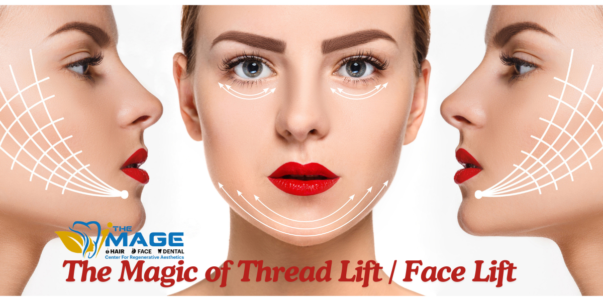 the-Basics-of-Thread-Lifts-and-Face-Lifts