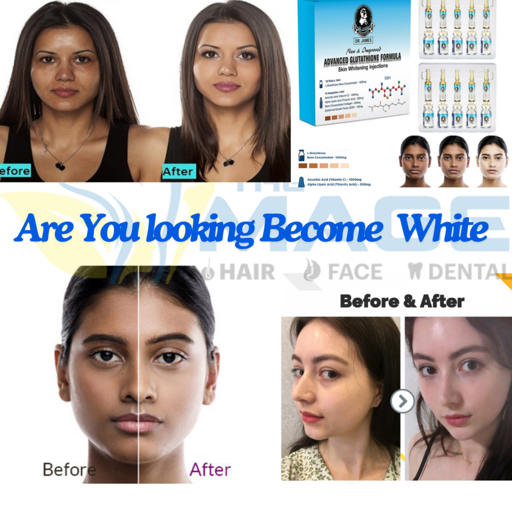 Collagen White Extra Anti-Aging Pills – Hyperpigmentation Treatment With Glutathione