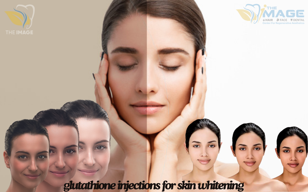 glutathione-injections-for-skin-whitening