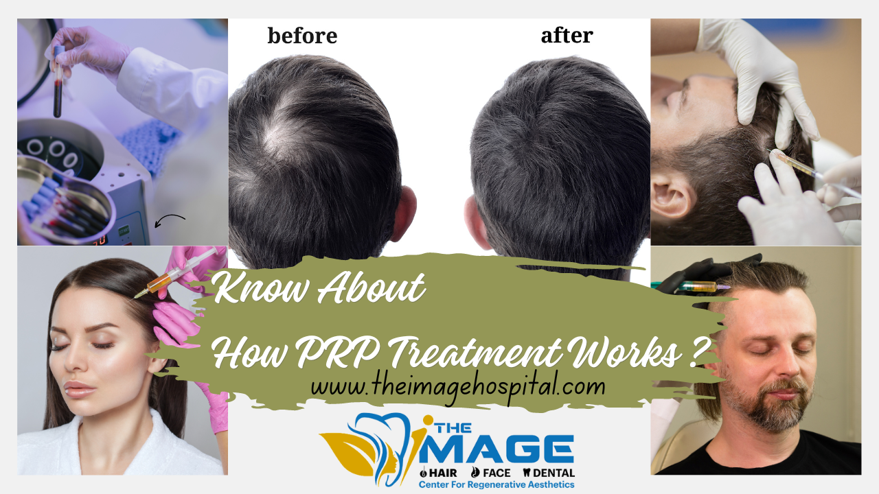 How PRP Treatment Works