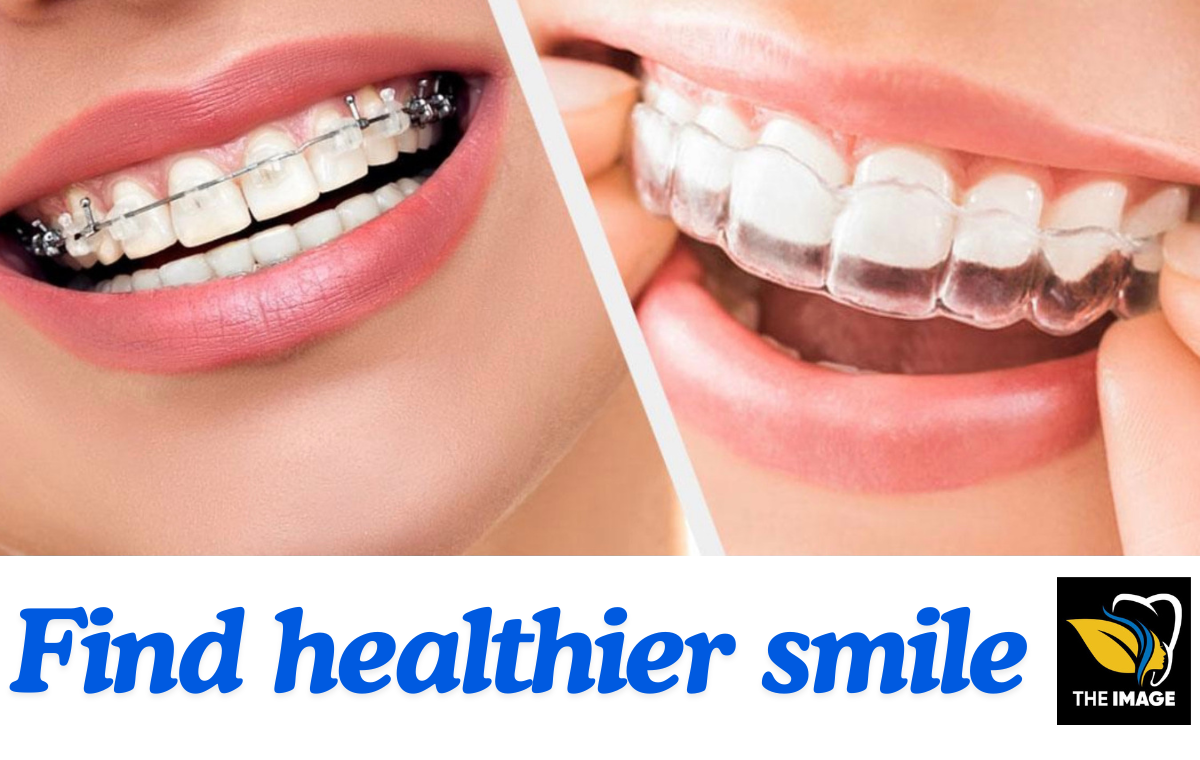 orthodontic treatment