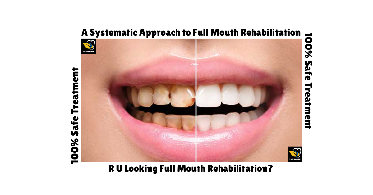 A Systematic Approach to Full Mouth Rehabilitation