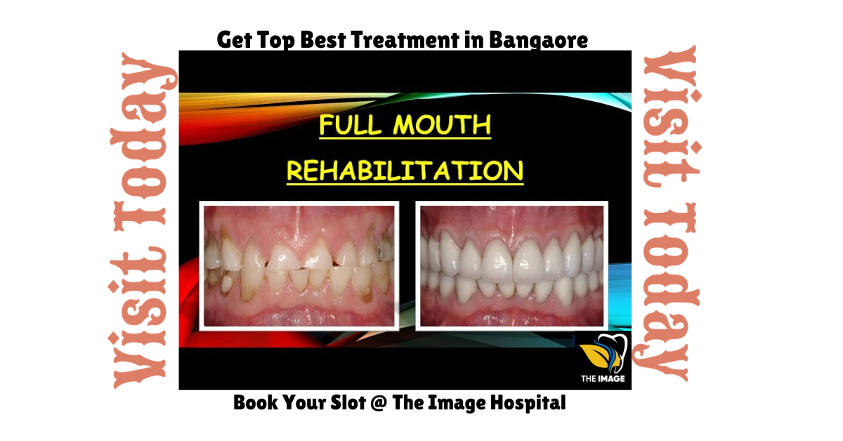 Get Top Best Treatment in Bangaore