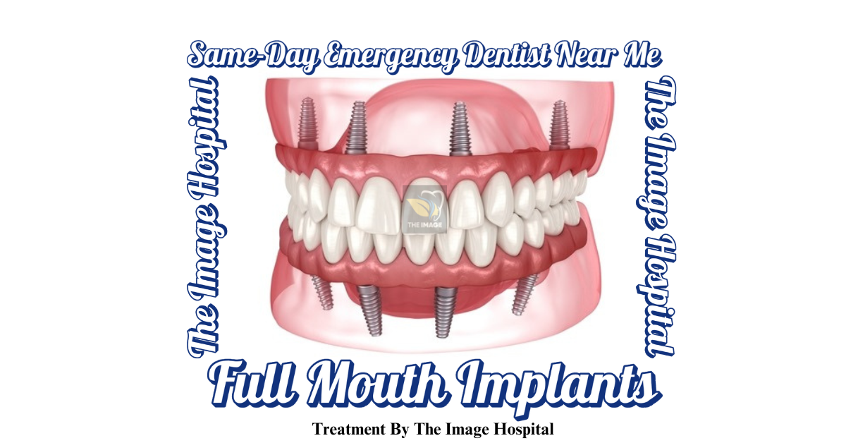 Same-Day Emergency Dentist Near Me for Full Mouth Implants