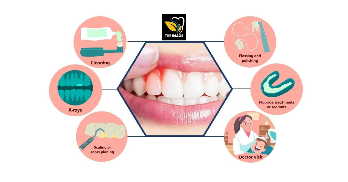 Gum Disease Treatment in Bangalore