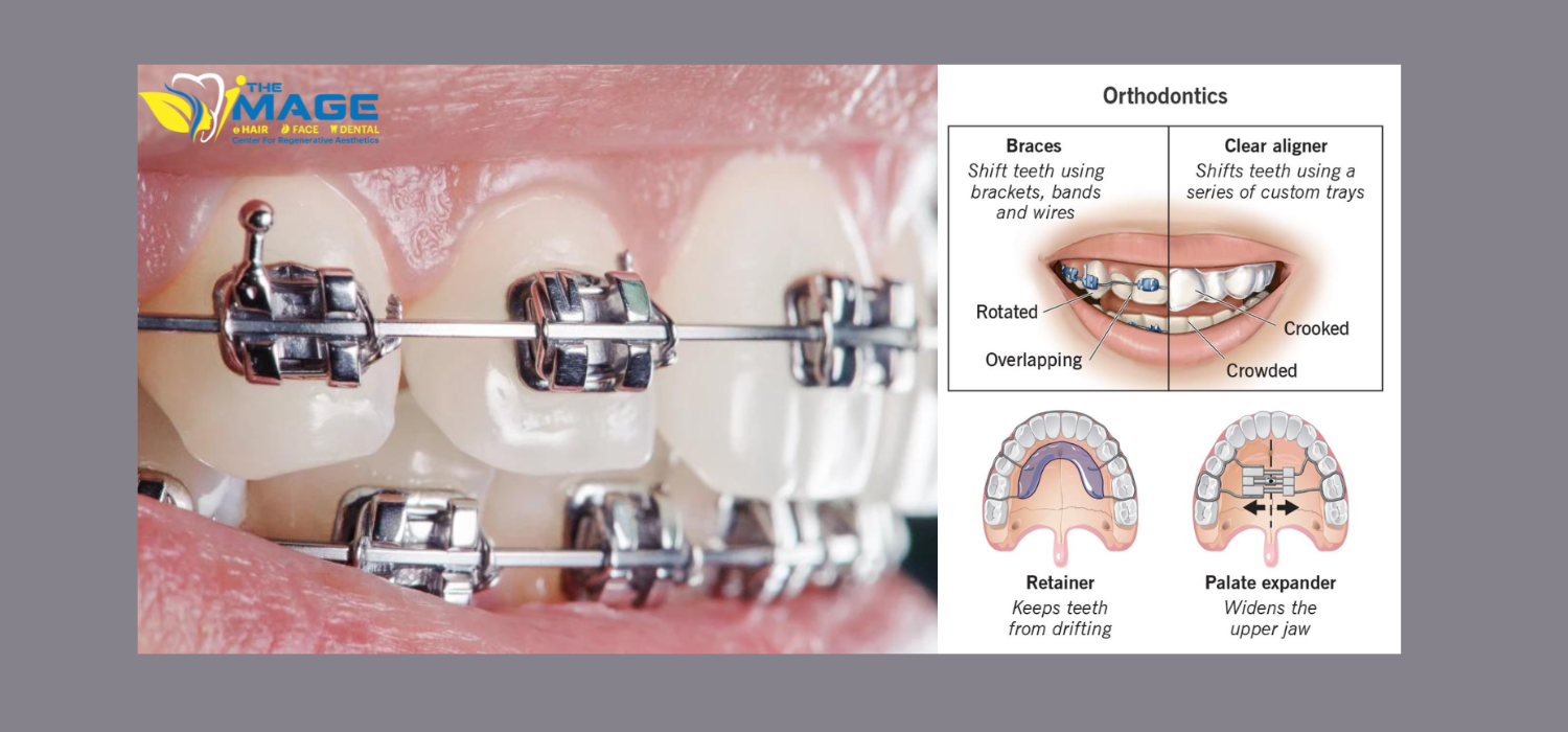 POST Premier Orthodontist Near Me