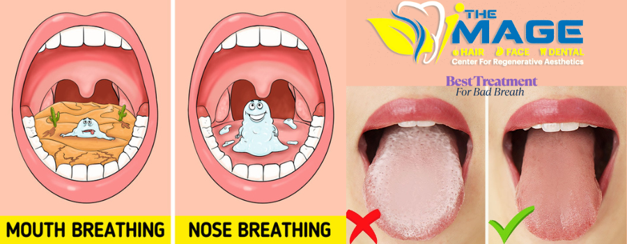 Best Treatment For Bad Breath