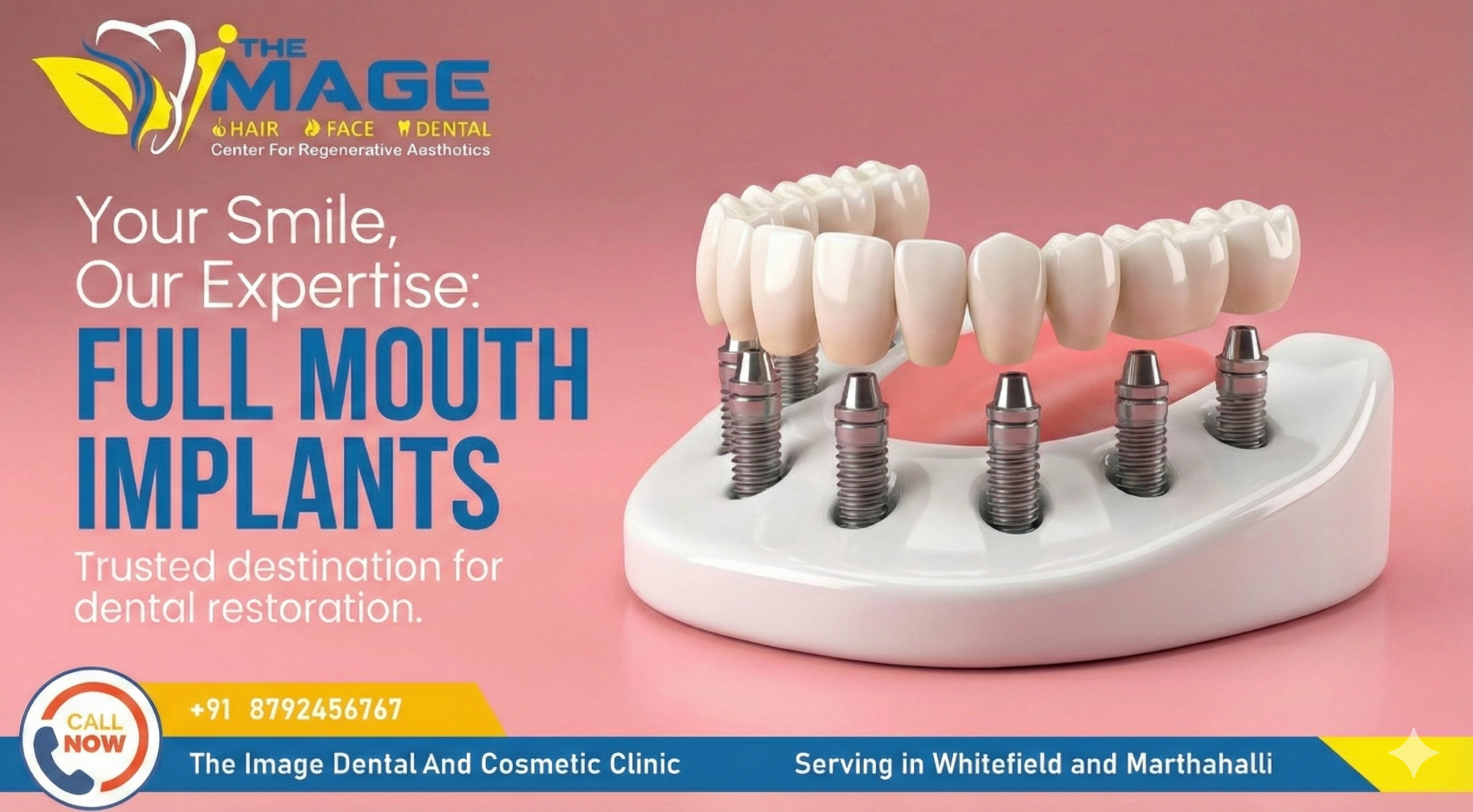 Full-Mouth-Dental-Implant-Treatment-at-The-Image-Dental-And-Cosmetics-Clinic